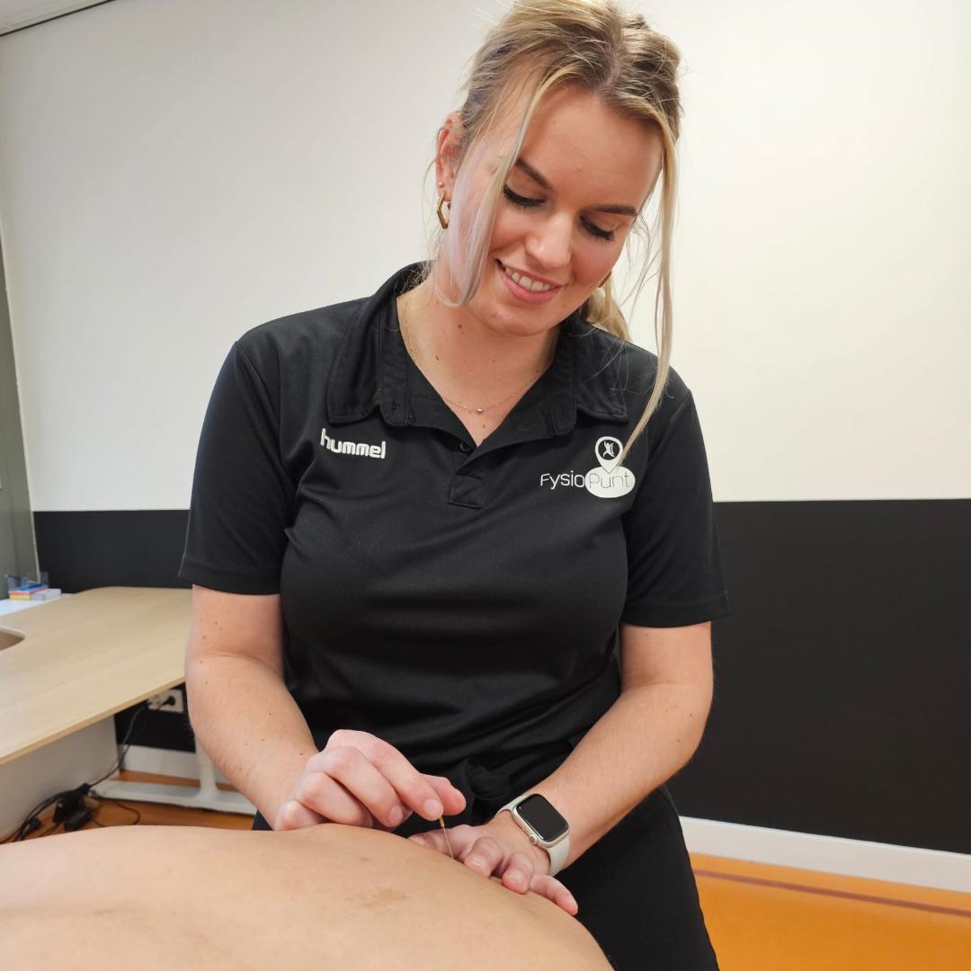 Dry needling